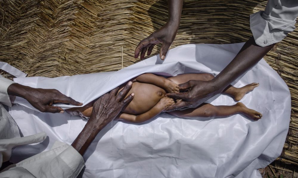 PEP BONET. Mortalidad infantil y pobreza. Bebedjia Republica de Chad 2013 min