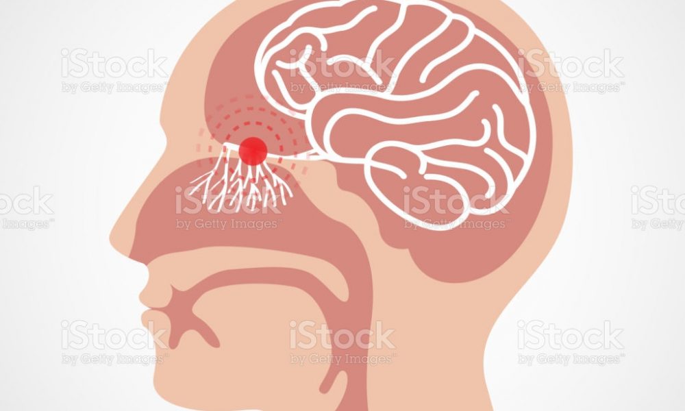 hiposmia
