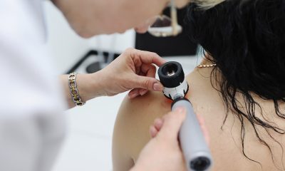 El HLA Santa Isabel incorpora un novedoso sistema efectivo en la detección precoz del cáncer de piel