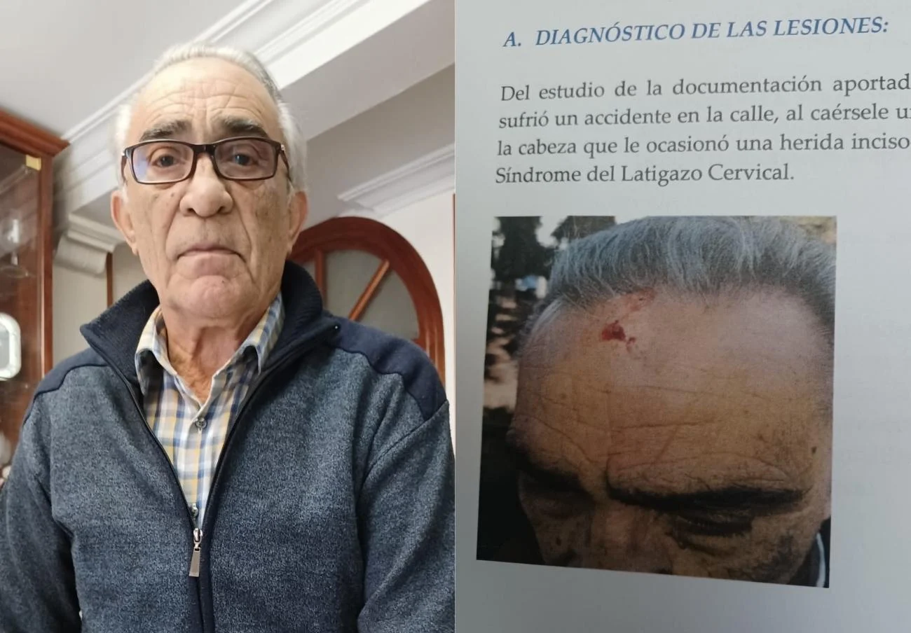 El Ayuntamiento de Sevilla, condenado a pagar 6.500 euros a un socio de FACUA por caerle un árbol